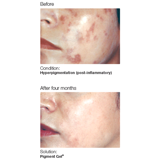 from-tips-to-toes-discoloration-graphic from-tips-to-toes-discoloration-graphic