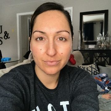 From_Tips_to_Toes_Southington_Chemical_Peel_Testimonial From_Tips_to_Toes_Southington_Chemical_Peel_Testimonial